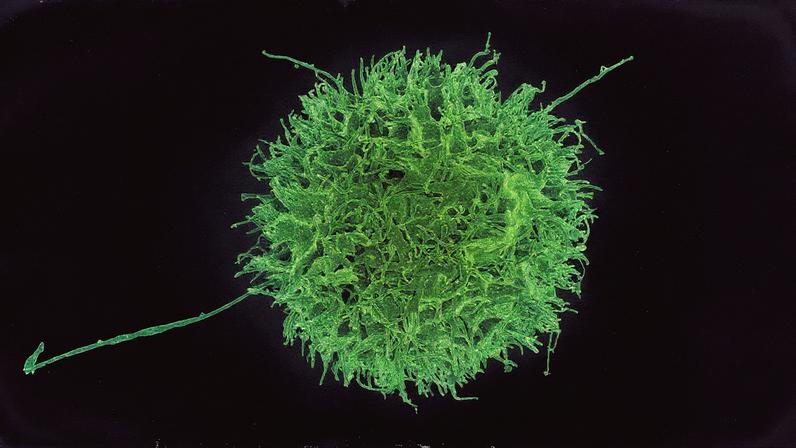 A new study identifies genetic modifications that make “natural killer” cells more effective at destroying cancer cells.