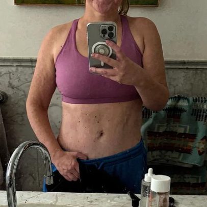 Amy Schumer exibe abdômen plano após intensa transformação de peso