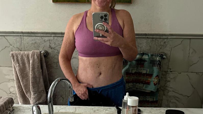 Amy Schumer again showed off her dramatic weight loss with a mirror selfie of her abs. Amy Schumer/Instagram