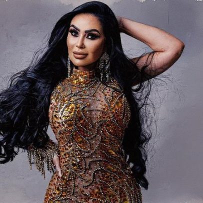 Musa desiste de desfilar no Carnaval após gastar mais de R$ 300 mil em plásticas