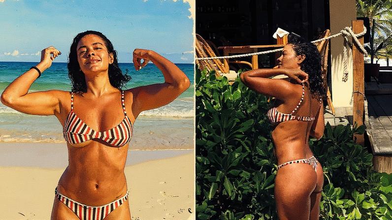 Bella Campos faz procedimentos estéticos após fim das gravações de 'Vale Tudo' — Foto: JK Estética Avançada