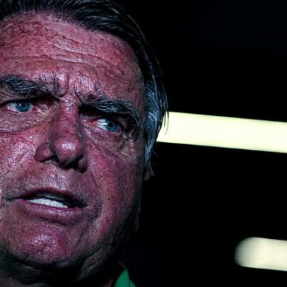 Machado aponta deterioração gradual da saúde de Bolsonaro