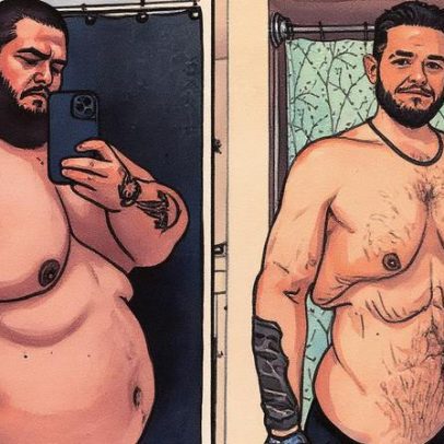Influencer perde 150 kg e remove 7 kg de pele em transformação impressionante