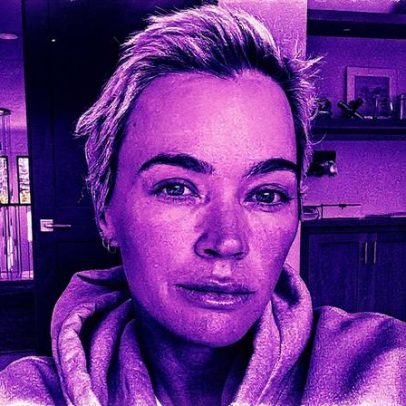 Teddi Mellencamp divulga importante atualização sobre sua luta contra o câncer estágio 4