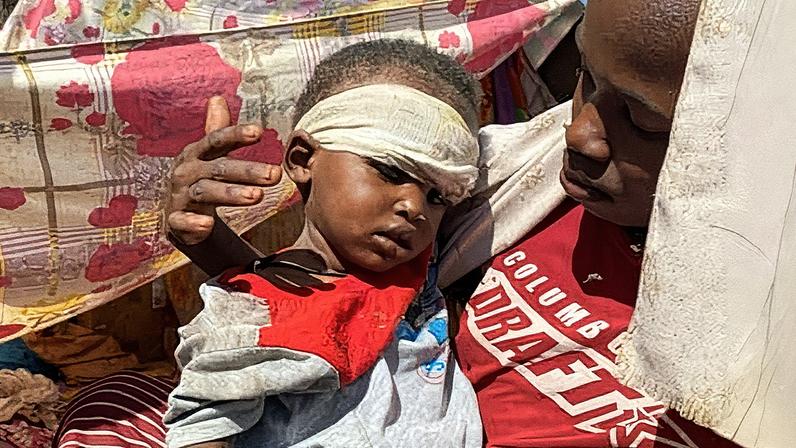 A child whose family fled violence perpetrated by the Rapid Support Forces in El Fasher receives treatment at a displacement camp.