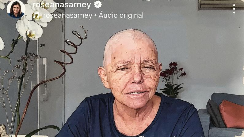 Roseana Sarney expõe batalha contra câncer. (Foto: Reprodução / Intsagram @ roseanasarney)