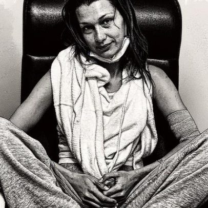 Bella Hadid fala sobre ansiedade médica em meio à luta contra a doença de Lyme