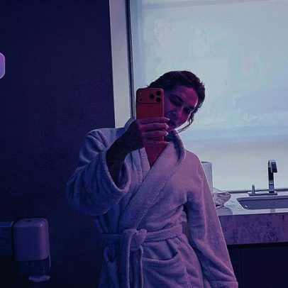 Virginia Fonseca faz tratamento para cicatrizes de acne após desabafo sobre manchas