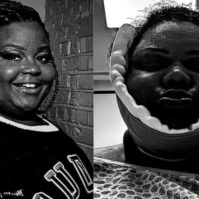 MC Carol faz cirurgia estética após perder quase 70 kg; veja antes e depois